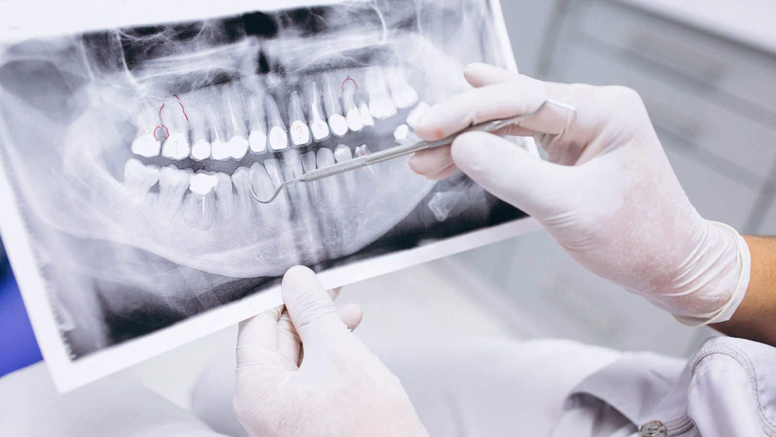 Manchester Dentistry and Implants