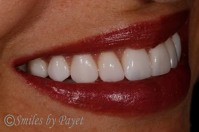 Smiles by Payet Dentistry of Charlotte